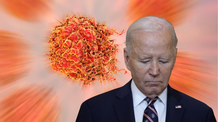 Cáncer de próstata