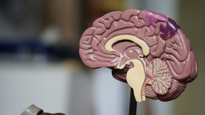 3 pruebas claves para realizarle a una persona y confirmar si está sufriendo un derrame cerebral
