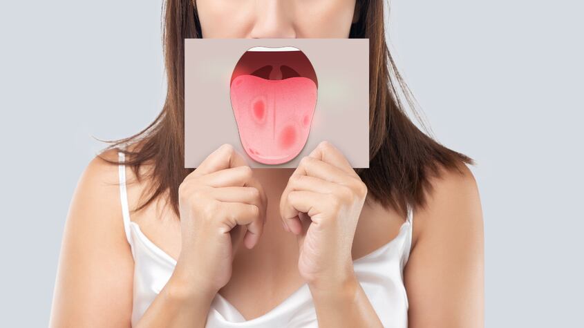 Dime de qué color tienes la lengua y te diré cuál es tu estado de salud