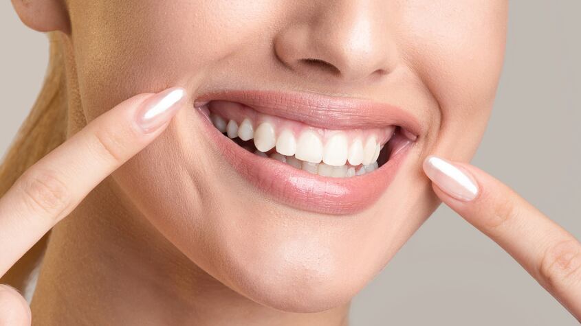 Dientes blancos