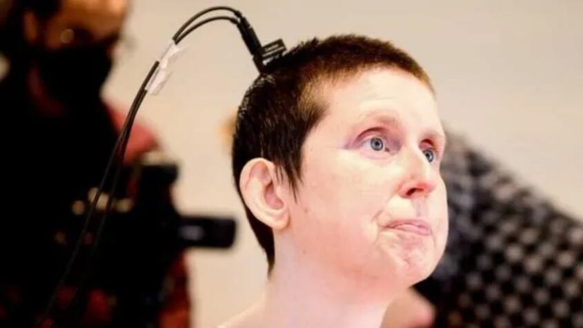 La IA ayudó a comunicarse a una mujer que llevaba en silencio más de 18 años