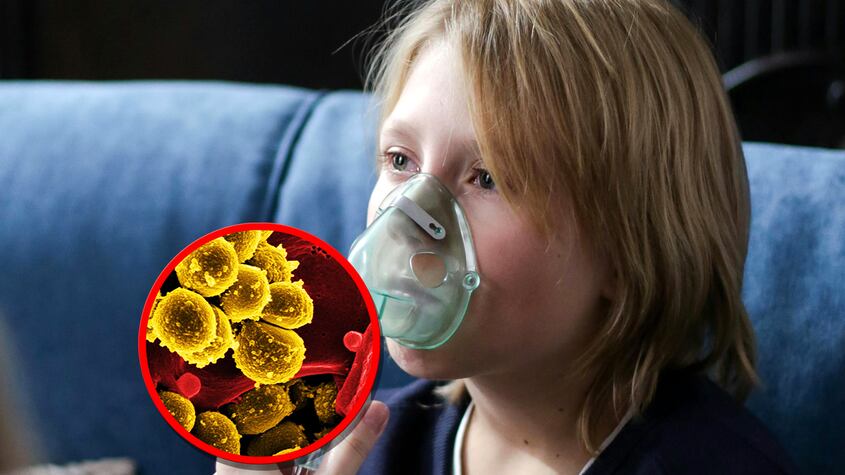 Enterovirus en los niños