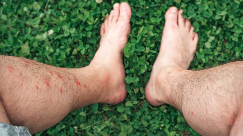 Efecto 3 en 1: el jabón que limpia y ahuyenta mosquitos sin químicos