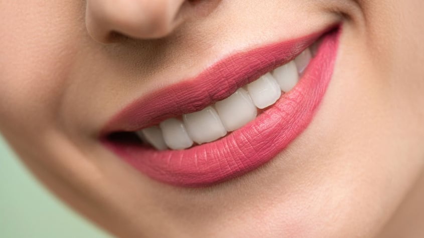 Dientes blancos y saludables.