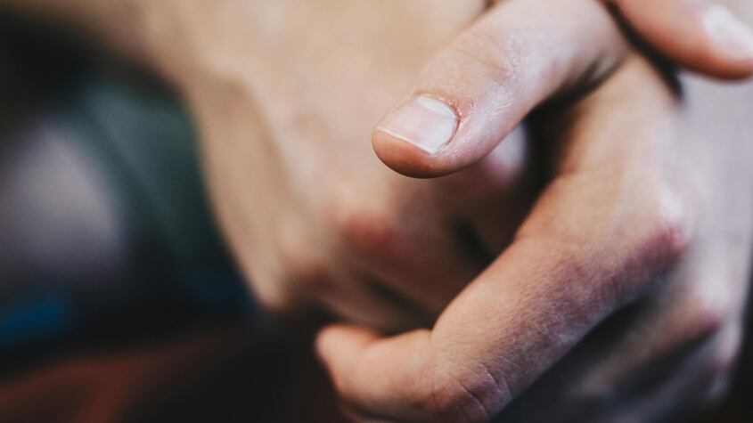 Las consecuencias para la salud que puede traer “comerse las uñas”