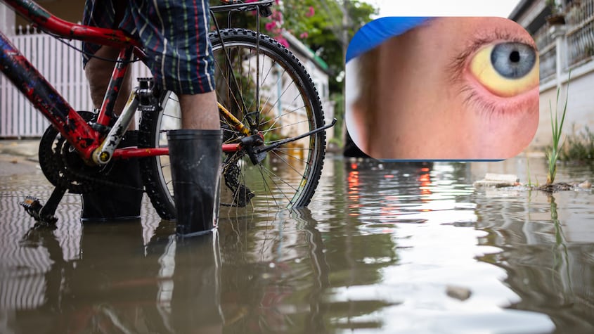 ¿Qué es la leptospirosis? La enfermedad que mantiene en vilo a Valencia